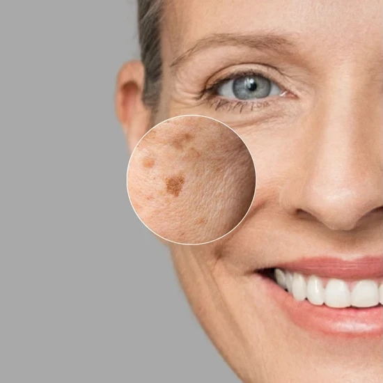 Janssen Dark Spot Perfector | Serum for Pigmentation Spots 30 ml