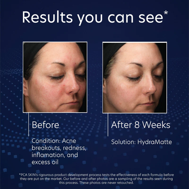 PCA Skin HydraMatte | Mattifying Cream for Oily Skin 50 ml
