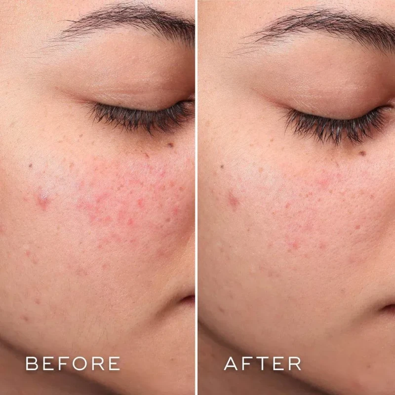 Medik8 Press & Clear Refill | Refillable BHA Toner for Problem Skin 150 ml